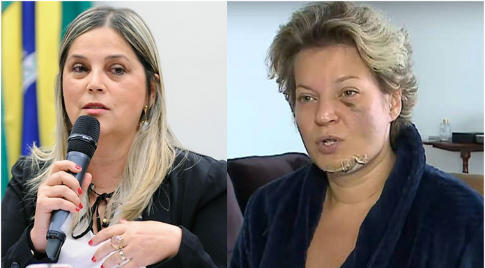 “A Polícia deve investigar o marido”, diz psicóloga sobre fraturas em Joice Hasselmann "A Polícia deve investigar o marido", diz psicóloga sobre fraturas em Joice Hasselmann